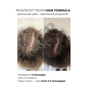 Hair Formula SkinSculpt - сыворотка для роста и против выпадения волос 1х10ml
